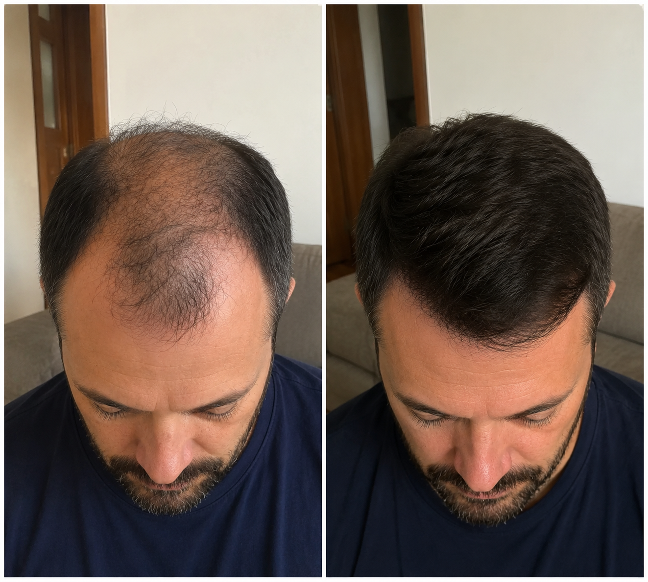 Before & After – David